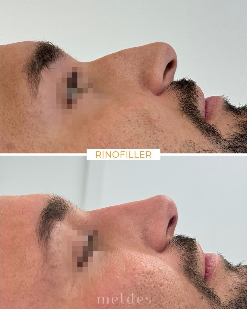 imgi_20_656647043_18112481116781753_6762864460652054972_n