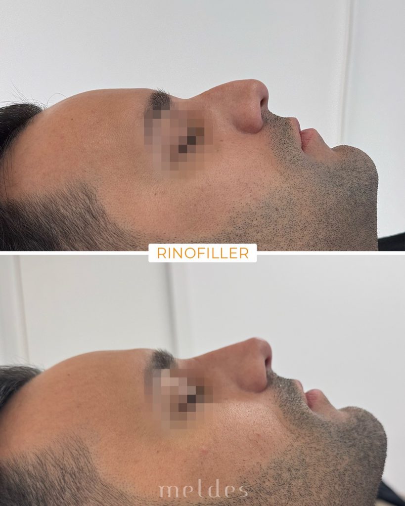 imgi_22_656799685_18112272775781753_1100791929251008204_n