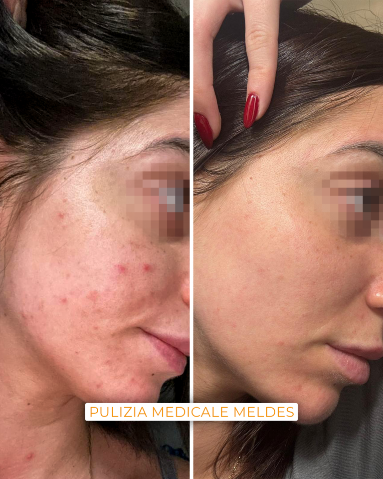 pulizia viso medicale