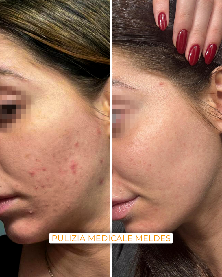 pulizia viso medicale