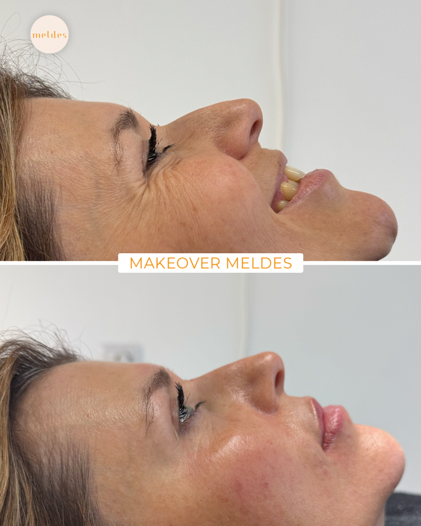 makeover meldes