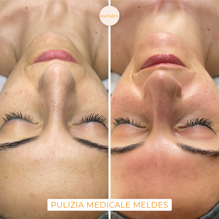 pulizia viso medicale