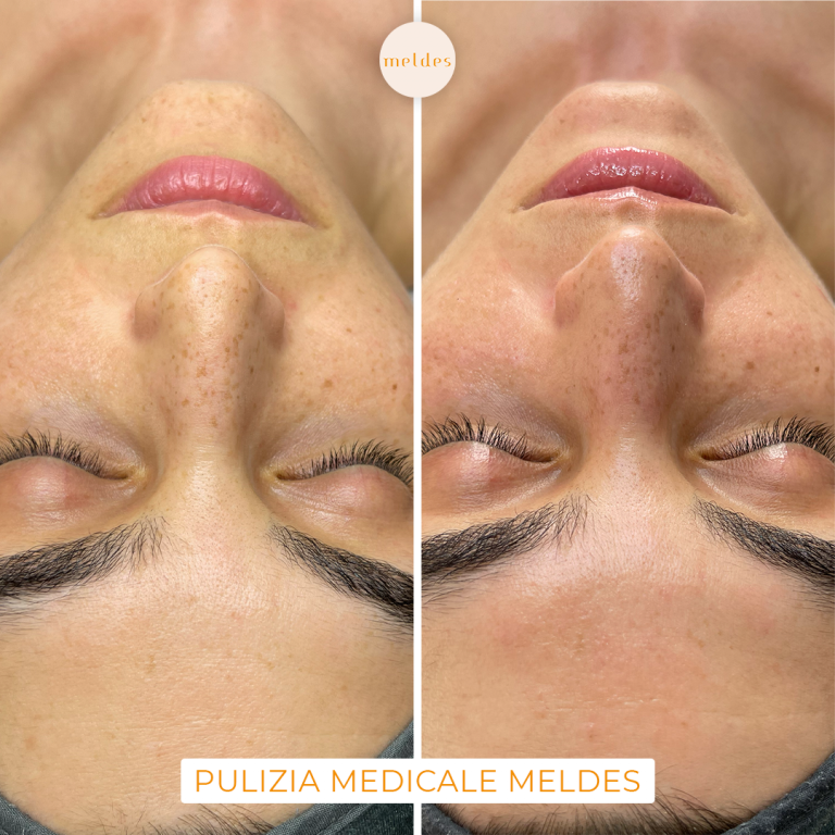 pulizia viso medicale