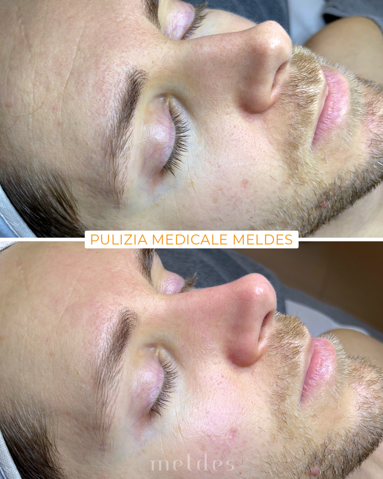 pulizia viso medicale